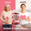 Cranberry Gummies – 1000 mg